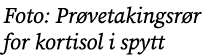 Foto: Pr vetakingsr r for kortisol i spytt