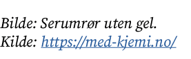 Bilde: Serumr r uten gel. Kilde: https://med kjemi.no/