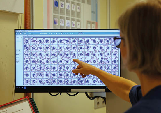 En person med briller peker p en dataskjerm som viser et mikroskopbilde av celler i et laboratorium.  KI-generert beskrivelse