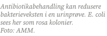 Antibiotikabehandling kan redusere bakterieveksten i en urinpr ve. E. coli sees her som rosa kolonier. Foto: AMM.